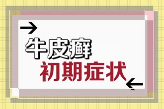 青少年如何做能够防止牛皮癣的到来